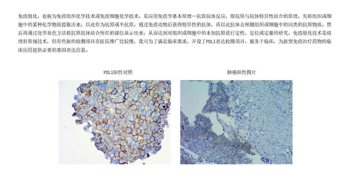 4檢測項目- IHC平臺.jpg